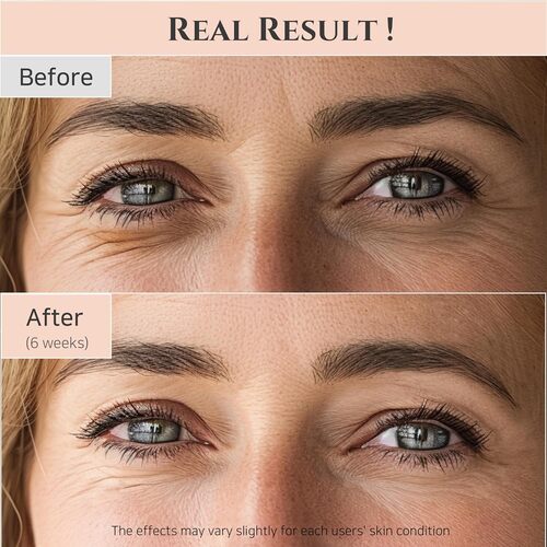 [Beauty of Joseon] Revive Eye Serum : Ginseng + Retinal 30ml