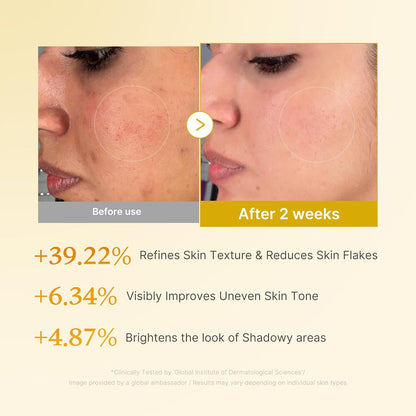 [MEDICUBE] Kojic Acid Turmeric Resurfacing Toner 250ml