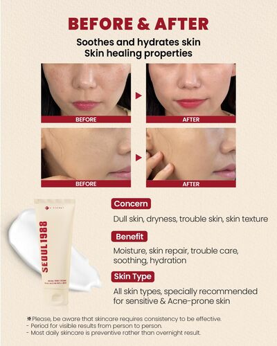 [K Secret]SEOUL 1988 Cream : Snail Mucin 93% + Rice
