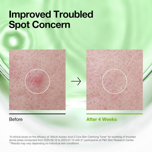 [ANUA] Azelaic Acid 3 + CICA Toner