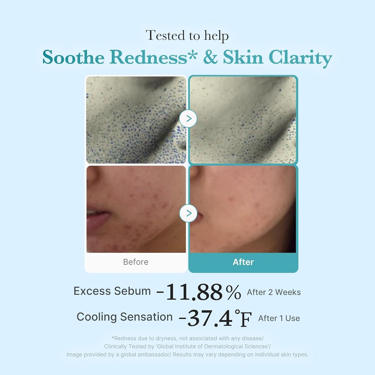[MEDICUBE] Azelaic Acid Niacinamide Clear Toner 250ml