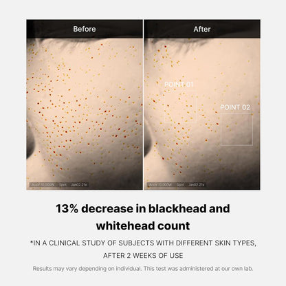 [MEDICUBE] Zero Pore One Day Serum 30ml