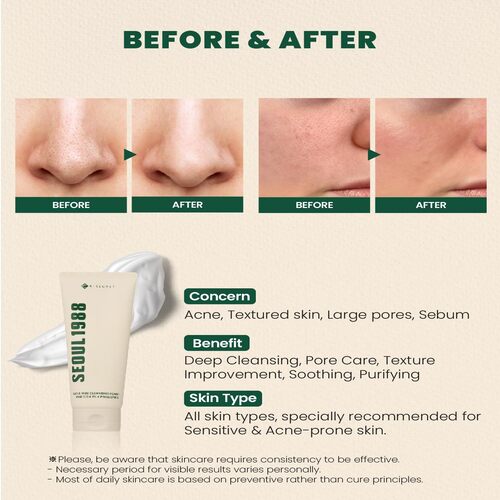 [K Secret] SEOUL 1988 Cleansing Foam : Pine Cica 1% + Probiotics 150ml