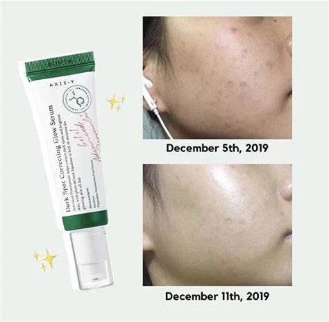 [AXIS-Y] Dark Spot Correcting Glow Serum
