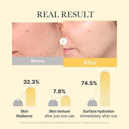 [MEDICUBE] Kojic Acid Turmeric Brightening Gel Mask