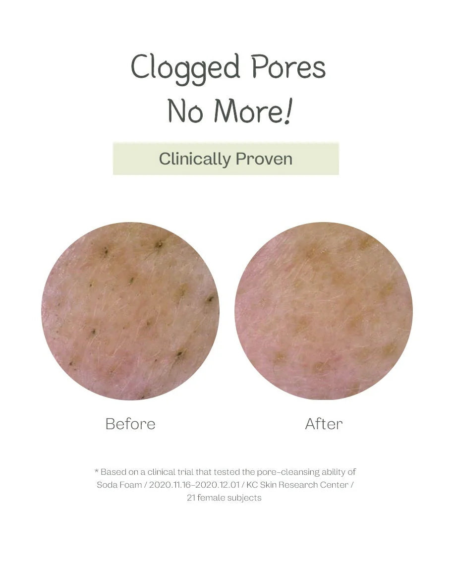 [Ma-nyo] Deep Pore Cleansing Soda Foam