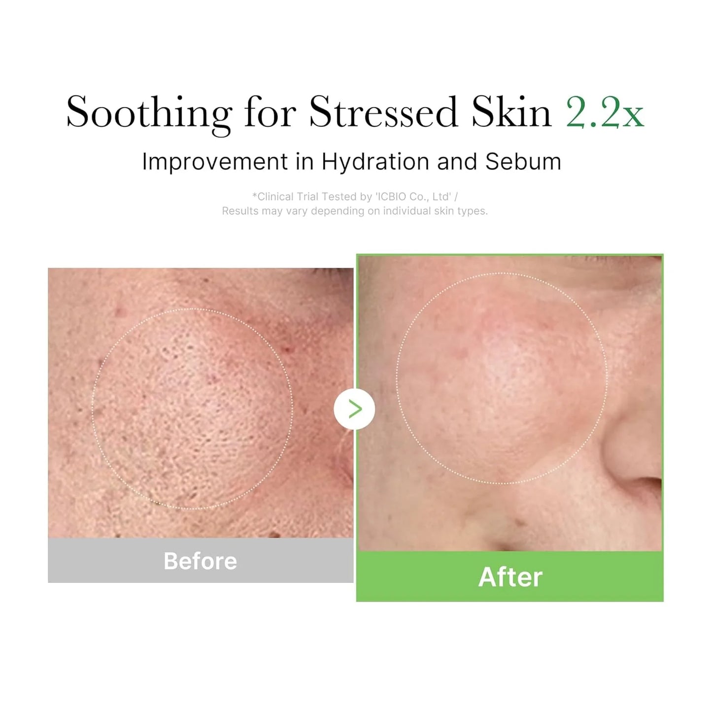 [Medicube] Exosome Cica Calming Cream