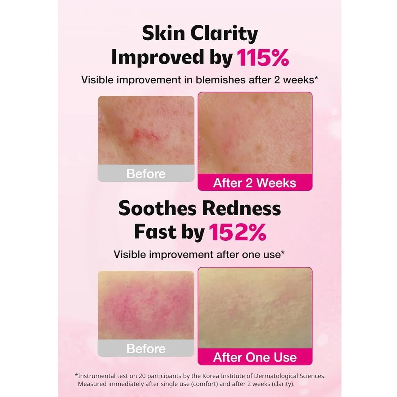 [ISOI] Blemish Care Up Serum
