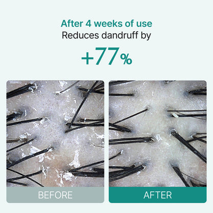 [lilyeve] Scalp:Turn Cica PDRN Brush Ampoule 100ml