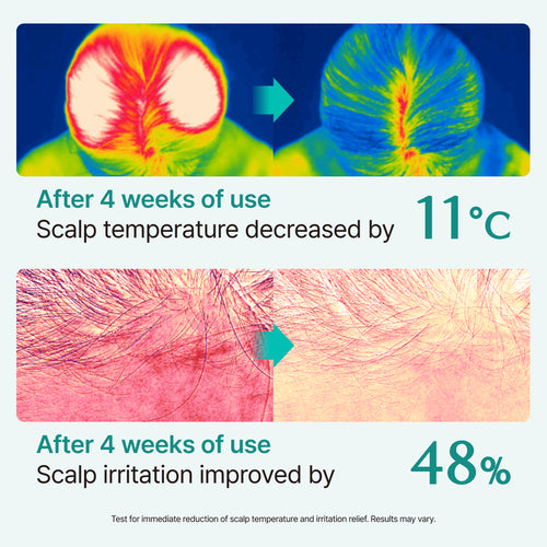[lilyeve] Scalp:Turn Cica PDRN Brush Ampoule 100ml