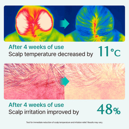 [lilyeve] Scalp:Turn Cica PDRN Brush Ampoule 100ml