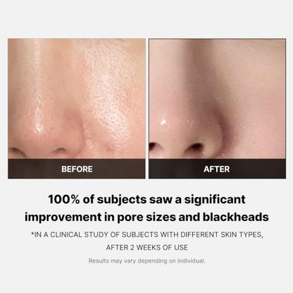 [MEDICUBE] Zero Pore Pad (70 pads)